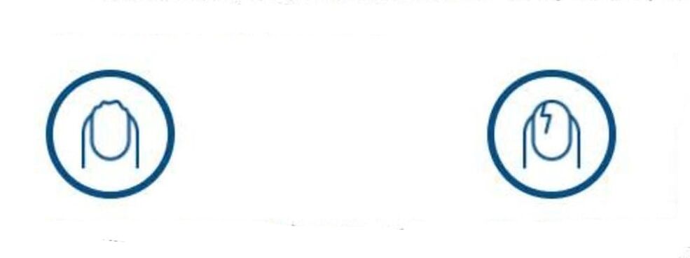 a köröm deformációja gombás fertőzés következtében